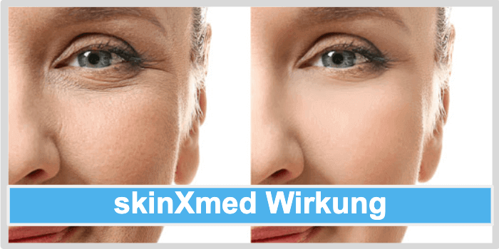 skinXmed Wirkung