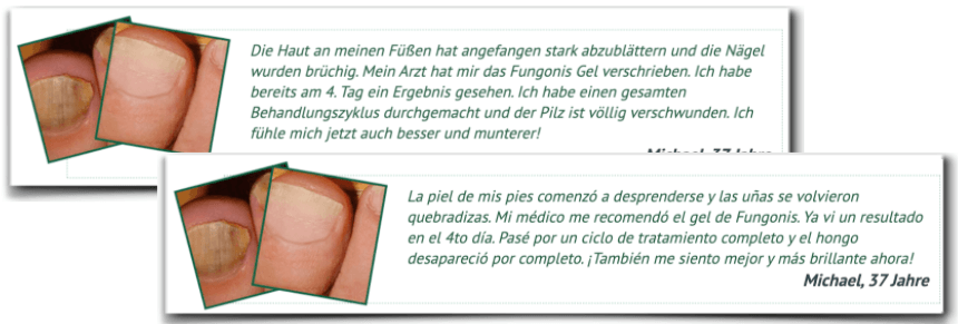 Fungonis Gel gefaelschte Erfahrungsberichte