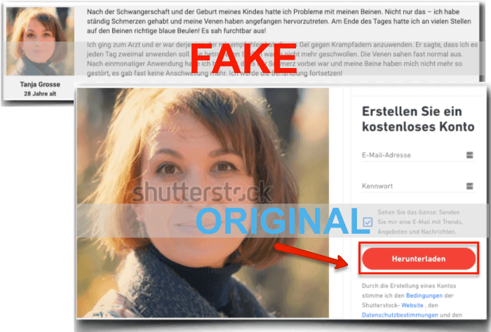 Varikosette Fake Erfahrungen Bewertungen