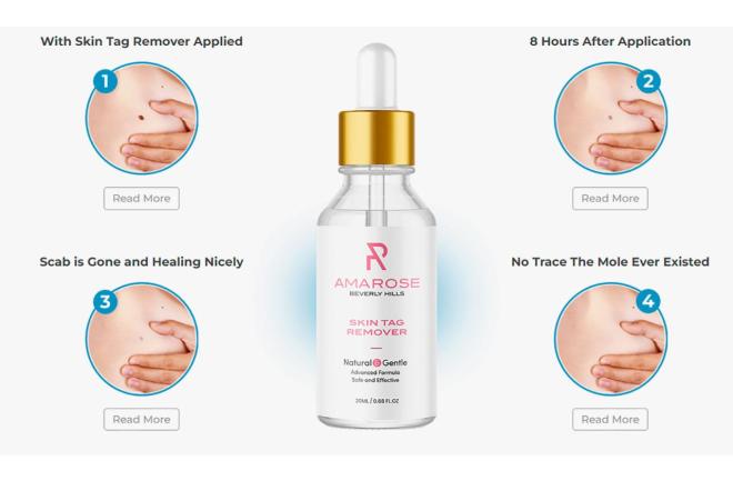 Amarose Skin Tag Remover Steps