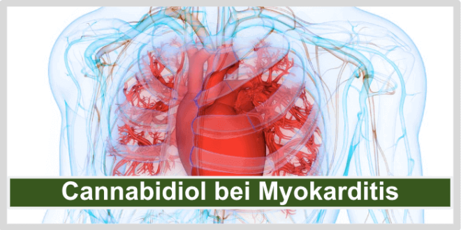 Cannabidiol bei Myokarditis Titelbild